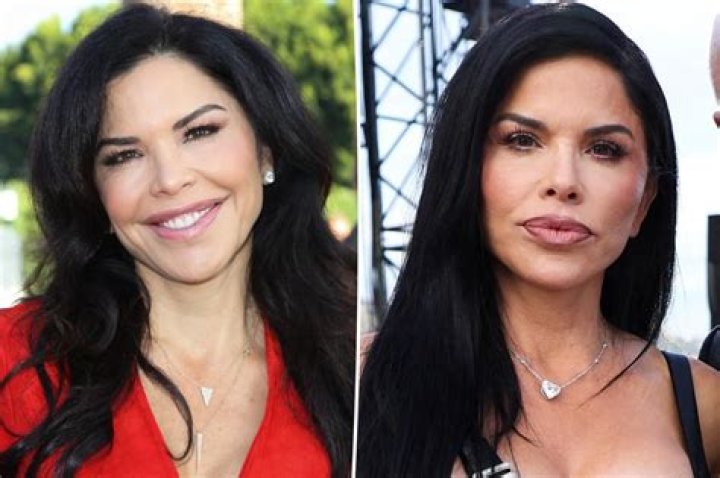 Plastic Surgery Before And After ·